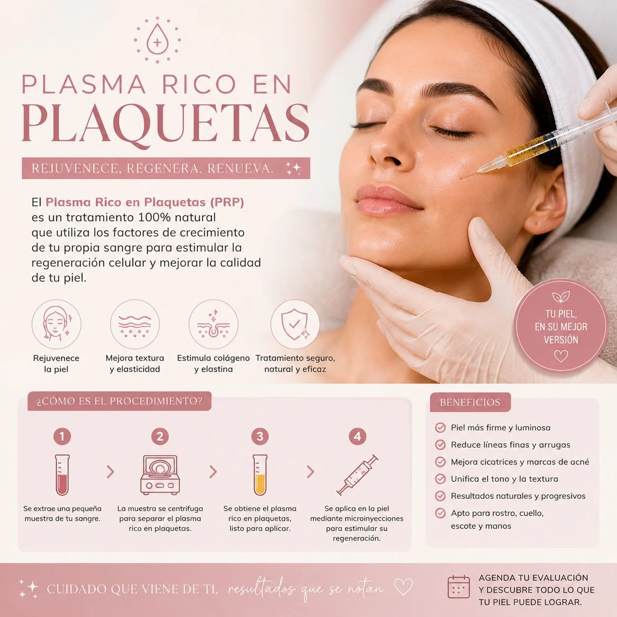 Plasma rico en plaquetas