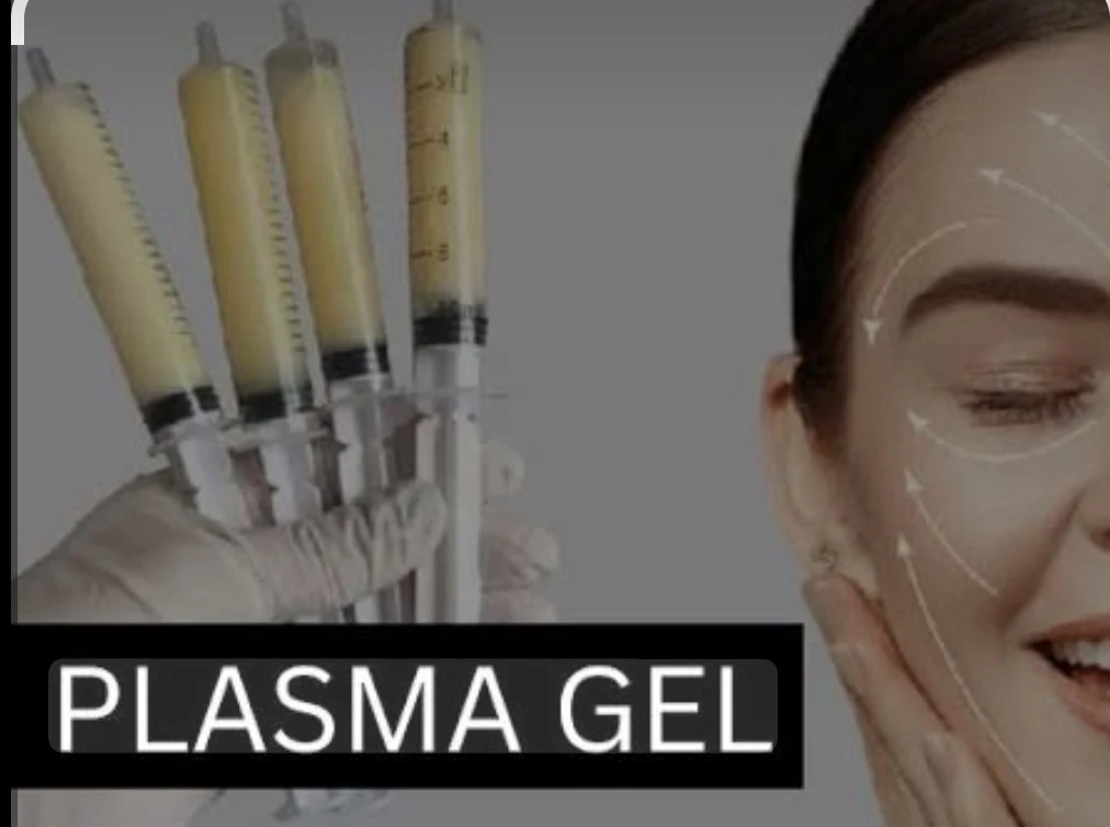 Plasma gel